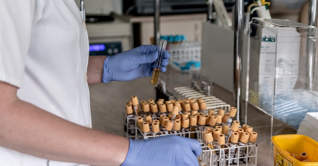functional-blood-testing-analysis-chemistry-lab Functional Blood Chemistry analysis enables us to spot patterns that can indicate a myriad of health conditions and gain insight into managing them. What that means for our patients is the ability to rule out a number of possible issues such as; toxicity challenges, vitamin deficiencies, insulin resistance, inflammation, anemia, and other problems not often visible during a physical exam.