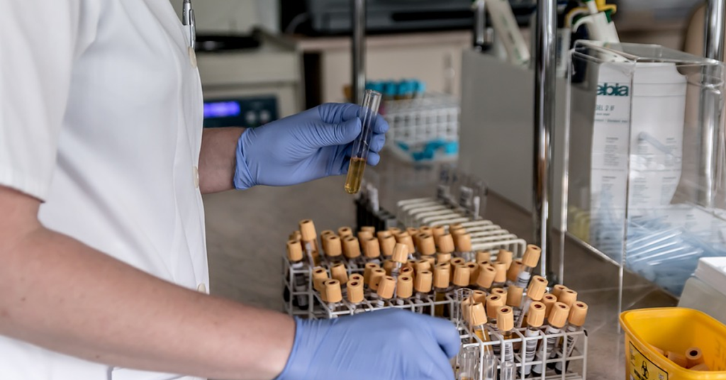 Functional Blood Chemistry analysis enables us to spot patterns that can indicate a myriad of health conditions and gain insight into managing them. What that means for our patients is the ability to rule out a number of possible issues such as; toxicity challenges, vitamin deficiencies, insulin resistance, inflammation, anemia, and other problems not often visible during a physical exam.