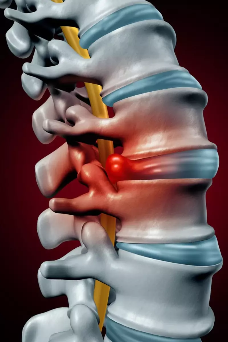 Low back pain solutions in Chattanooga. The Tennessee Valley’s Leader in Drug-free, Non-Surgical Treatments of Low Back Pain, Spine Pain, Knee Pain, and Joint Pain. With Dr. Jeff Hall's extensive knowledge, he understands the value of getting patients back into life without surgical intervention.