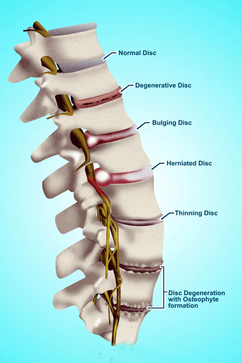 Decompression treatments for pain from the Tennessee Valley’s Leader in Drug-free, Non-Surgical Treatments of Low Back Pain, Spine Pain, Knee Pain, and Joint Pain.